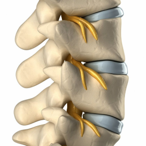 Spondylolisthesis Treatment In Mumbai - Dr. Saijyot Raut