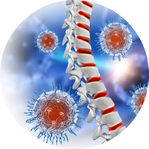 SPINAL INFECTIONS