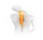 Osteoarthritis of the neck